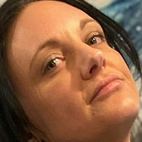 amputeedarling Naakt