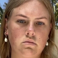 Chynnaclair Naakt