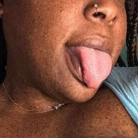 freckledfantasy5 Naakt