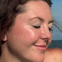 gingerfreckles Naakt