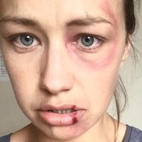 Lorna Dempsey Naakt