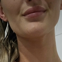 Marie Müller Naakt