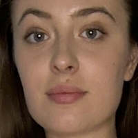 MidnightAuraFlow Naakt