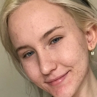 Trippi Miki Naakt